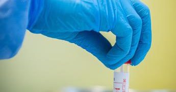 Covid oggi Lazio, 580 contagi e 2 morti: a Roma 296 casi