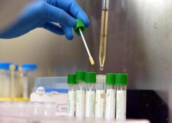 Covid Marche, 836 nuovi casi in 24 ore: i dati del 6 marzo