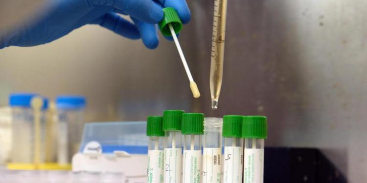 Covid Marche, 836 nuovi casi in 24 ore: i dati del 6 marzo