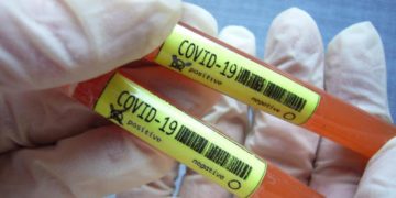 Covid Piemonte, 2.357 contagi e 45 morti: bollettino 18 marzo