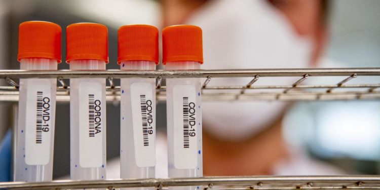 Covid Liguria, oggi 242 nuovi contagi e 13 morti: bollettino