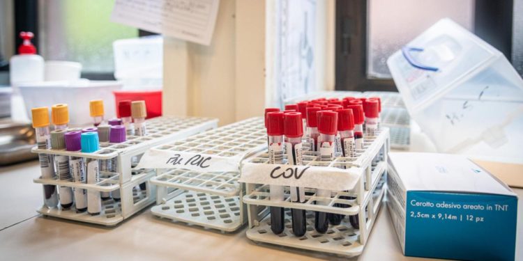 Covid Veneto, oggi 1.901 nuovi contagi e 84 morti: bollettino