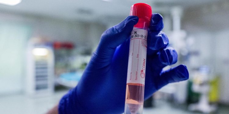 Covid Sardegna, oggi 74 nuovi contagi e 2 morti: bollettino