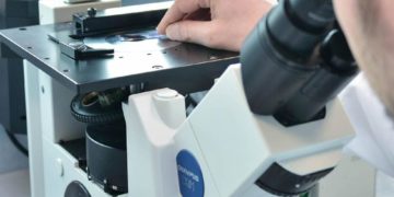 Parkinson, identificato uno dei meccanismi alla base della malattia