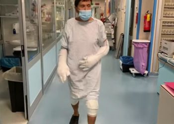 Gianni Morandi ustionato, primi passi in un video: “Sono fortunato”