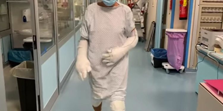 Gianni Morandi ustionato, primi passi in un video: “Sono fortunato”