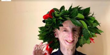Seconda laurea per Sammy Basso