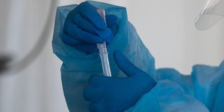 Covid Marche, 881 nuovi contagi: bollettino 10 marzo