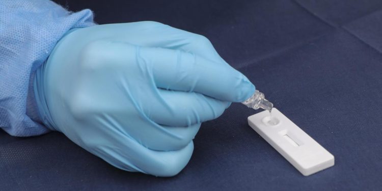 Covid Emilia Romagna, oggi 2.560 nuovi contagi e 47 morti: bollettino 20 marzo