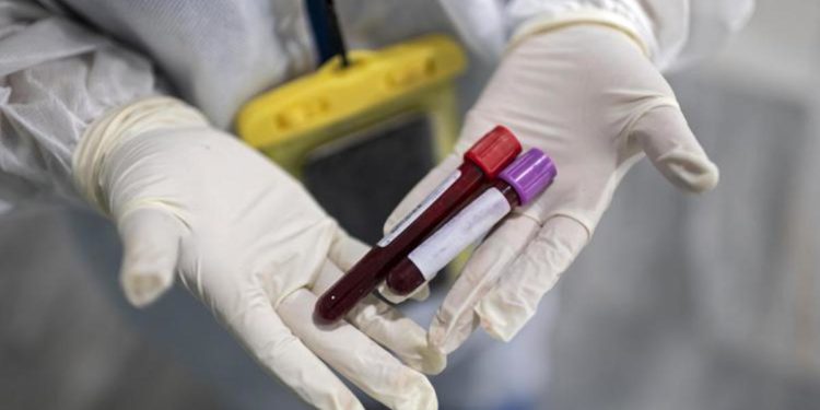 Covid Basilicata, 186 nuovi contagi e 1 morto: bollettino