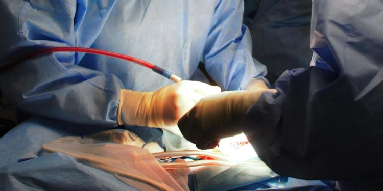 Tumore da rene a cuore rimosso col robot, operazione record a Milano