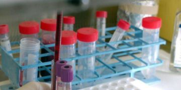 Covid Valle d’Aosta oggi, 2 contagi: bollettino 3 giugno