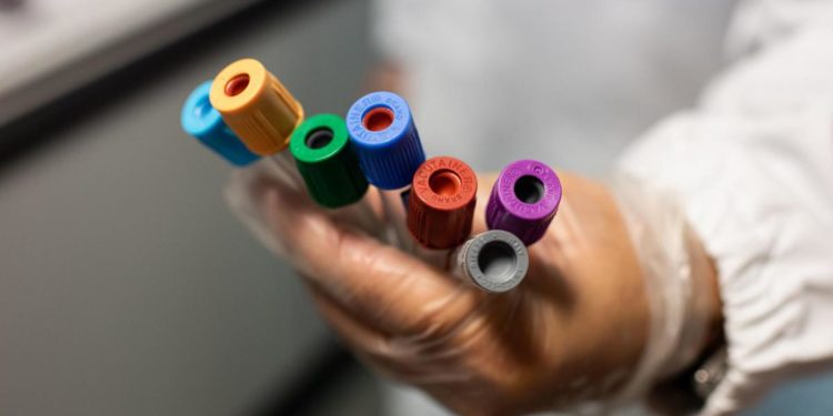 Covid Piemonte, oggi 59 contagi e 3 morti: bollettino 16 giugno