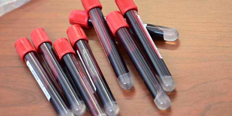 Covid oggi Sardegna, 9 contagi e 3 morti: bollettino 7 giugno