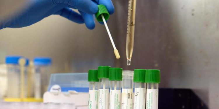 Variante Delta, Rasi: “Colpisce di più under 30, vaccinare giovani”