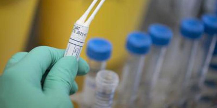 Covid Calabria, oggi 128 contagi e 5 morti: bollettino 6 giugno