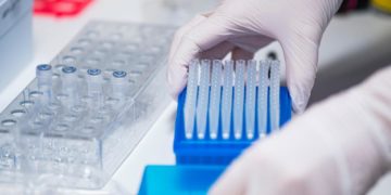 Covid, rischio diabete correlato al virus