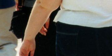 Sbraccia (Tor Vergata): “Contro obesità nuova terapia per perdere peso”