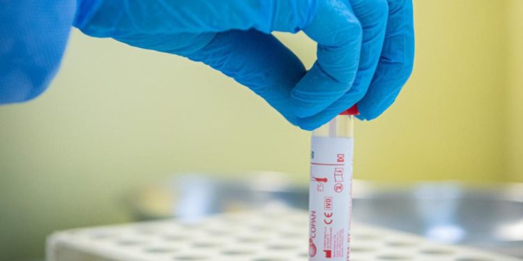 Variante Delta, l’immunologo: “Pericolo se supera il 20% dei contagi”