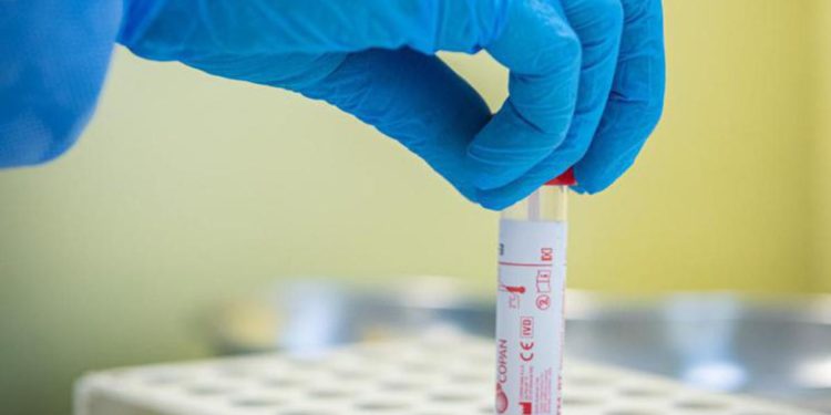 Covid oggi Emilia Romagna, 64 contagi e un morto: bollettino 28 giugno