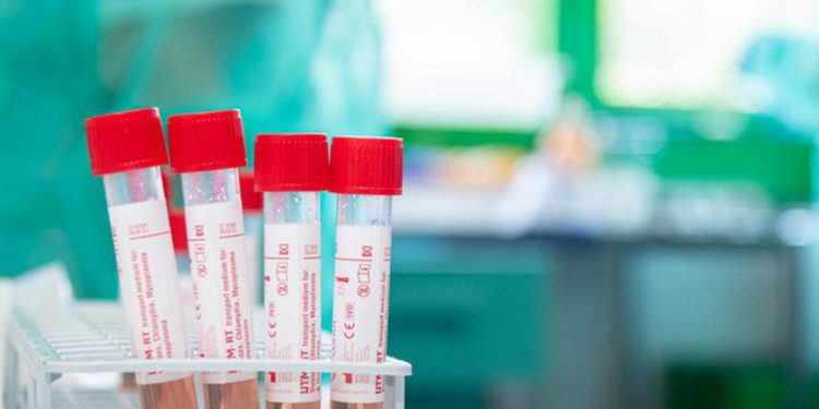 Covid Marche, oggi 125 nuovi contagi: bollettino del 2 giugno