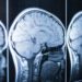 Traumi alla testa, un test rapido valuta eventuali lesioni