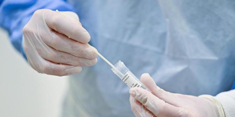 Covid oggi Gb, allarme per 43mila test molecolari sbagliati