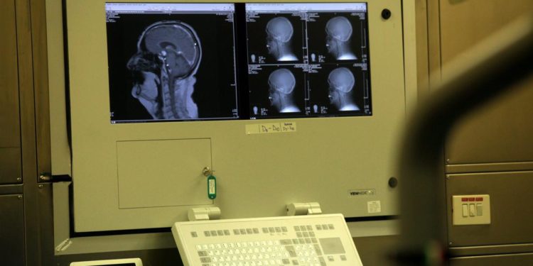 ‘YourMS’, il primo questionario per conoscere ‘la tua sclerosi multipla’