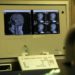 ‘YourMS’, il primo questionario per conoscere ‘la tua sclerosi multipla’