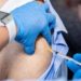 Gentile (Federico II): “Partire dall’ospedale per vaccinare contro l’herpes zoster”
