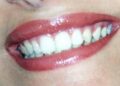 Dentista senza prenotazione a Roma, all’Isola Tiberina visite immediate per urgenze e controlli