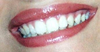 Dentista senza prenotazione a Roma, all’Isola Tiberina visite immediate per urgenze e controlli