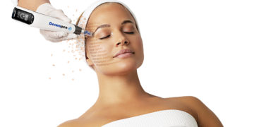 Microneedling viso, come farlo e soprattutto dove