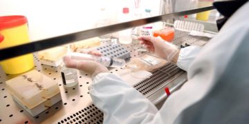 Malattie rare, La Marca (Meyer: “Con legge 167 sistema screening neonatale a regime”