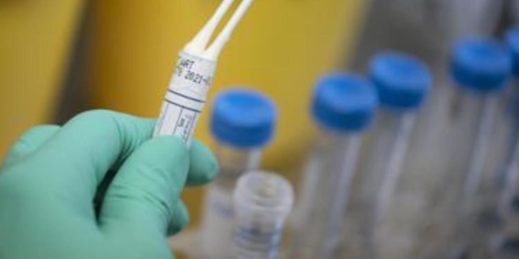 Variante Omicron e sintomi: meno pericolosa per polmoni, studi