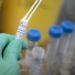 Variante Omicron e sintomi: meno pericolosa per polmoni, studi