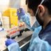 Variante Omicron, Bassetti: “Test antigenici rapidi non la rilevano, numeri falsati”