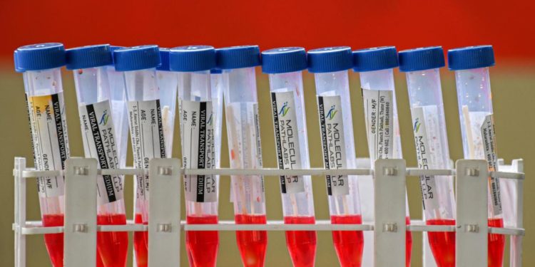 Covid oggi Veneto, 4.877 contagi e 23 morti: bollettino 31 gennaio