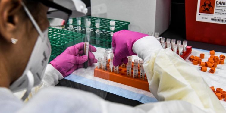 Covid endemico in Italia come influenza? Cosa dicono esperti