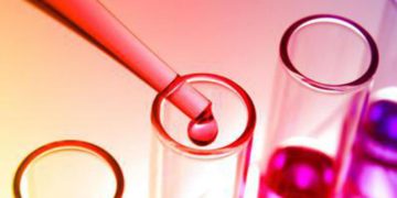 Barcellini (Policlinico Milano): “Con ravulizumab benefici per pazienti con emoglobinuria parossistica notturna”