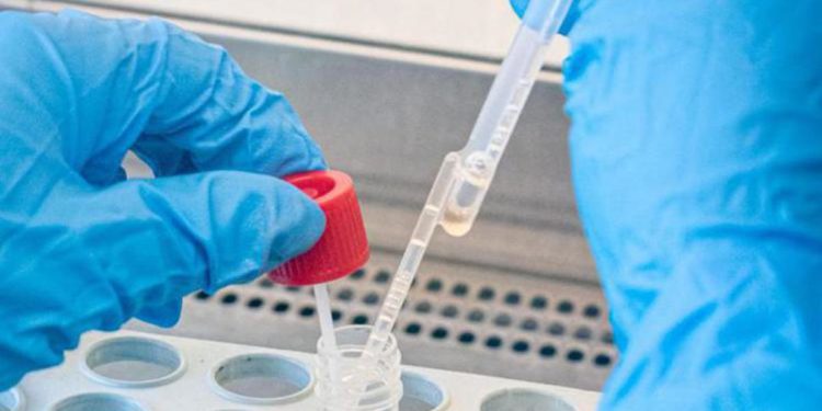 Covid oggi Abruzzo, 4.808 contagi e 1 morto: bollettino 6 gennaio