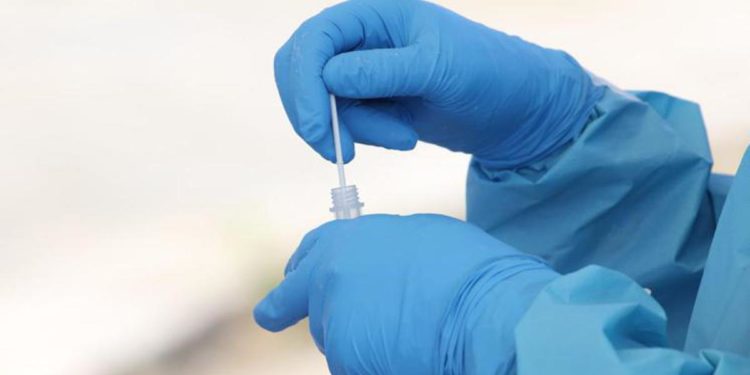 Variante Omicron, studio Gb: reinfezione per 2 casi su 3