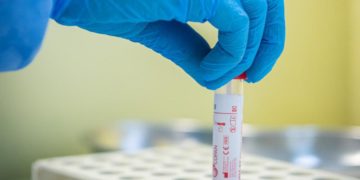 Covid oggi Emilia Romagna, 13.561 contagi e 38 morti: bollettino 25 dicembre