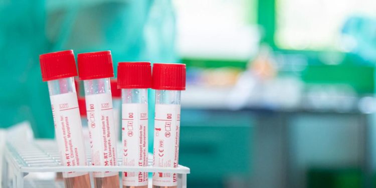 Variante Omicron, “all’81% il 3 gennaio”