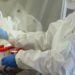 Trovato gene legato a Long Covid, setacciati Dna di migliaia pazienti