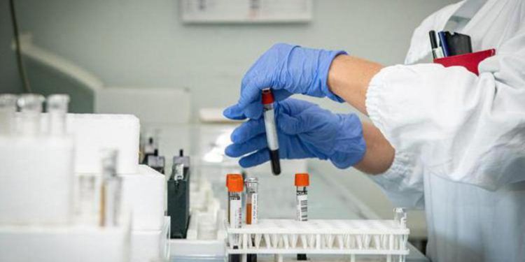 Covid oggi Basilicata, 867 contagi e 4 morti: bollettino 15 febbraio