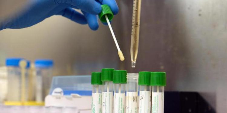 Covid oggi Piemonte, 6.920 contagi e 24 morti: bollettino 4 febbraio