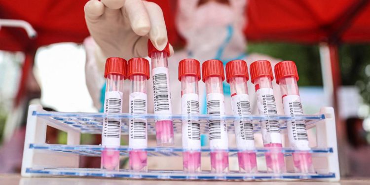 Covid oggi Puglia, 7.141 contagi e 37 morti: bollettino 2 febbraio