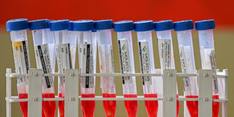 Covid oggi Vda, 93 contagi e 1 morto: bollettino 15 febbraio