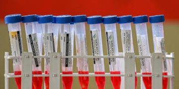 Covid oggi Piemonte, 3.670 contagi e 27 morti: bollettino 15 febbraio